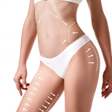 Liposuction em Gastonia / NC