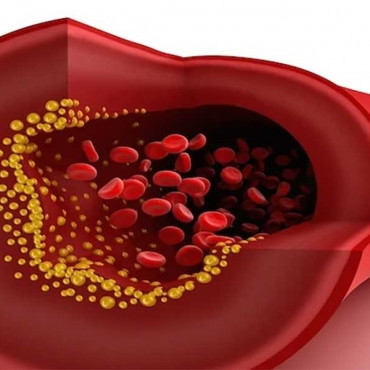 Total cholesterol em Woburn / MA