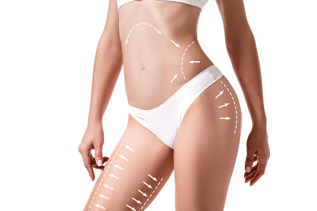 Liposuction in New Britain / CT